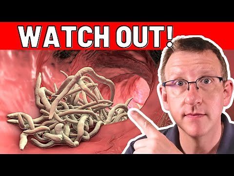 10 TOP early warning signs of PARASITES (ACT RIGHT NOW!)