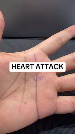 Palmistry: Triangle on Hand & Heart Attack Signs