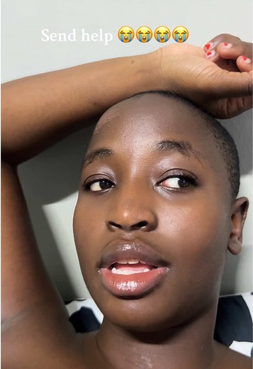 Effective Ways to Treat Boils and Cysts Quickly