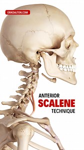 29 reactions | Anterior Scalene Technique The anterior scalene...
