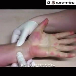 . Greetings my fellow NurseBros & NurseSisters here is what's called...