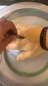 100K views · 419 reactions | friend removes giant splinter from hand...