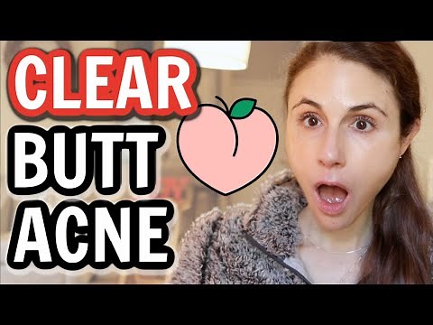 How to CLEAR BUTT ACNE FAST| Dr Dray