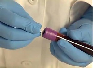 15 reactions · 3 comments | Hemocue HB 201 Especificaciones...