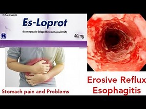 Es Loprot 40mg tablet uses in urdu