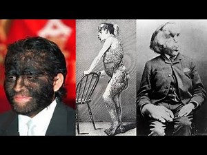 15 Human Oddities That Left Scientists Speechless