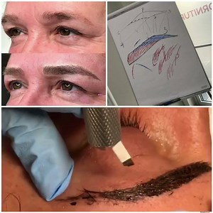 7.5K views | DermaFusion on Reels | Facebook