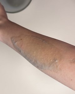 110K views · 126 reactions | Homemade painless body hair removal | Genius Club | Facebook