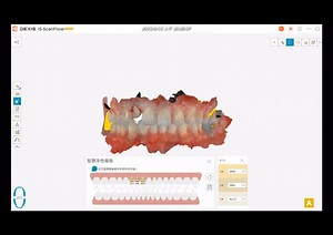 「IS ScanFlow 功能小百科」：檢查＆比色 『口掃機除了掃描外，能否比色呢？』 IS ScanFlow內建比色功能...