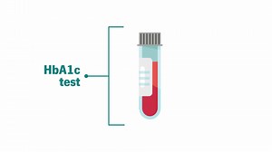2.4K views | ⚠️ Pay attention! ⚠️ Persistent thirst, frequent urination, unexplained weight loss, fatigue, and blurry vision could be signs of diabetes. Don't ignore these warning signals - early detection is key! 喝 #diabetes #bloodsugar #Utanokuvanhu #bettertogether | OrganiCare Africa | Facebook