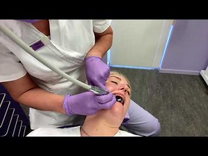 Korte instructie polijsten