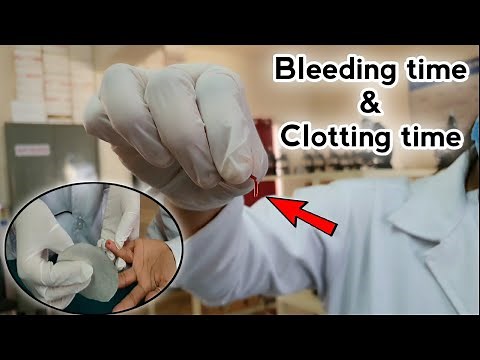 Bleeding time and Clotting time determination | BT CT test | Coagulation time