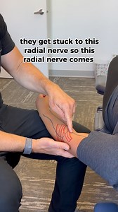 139 reactions · 27 shares | How we trace the nerves & find the nerve...