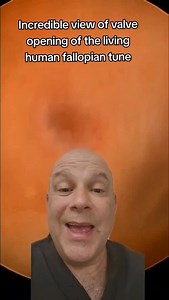 7.9K views · 1K reactions | incredible fertility video of the human fallopian tube #fallopiantube #infertility #IVF #ttc #infertilitywarrior #ivfwarrior #infertilityjourney by#Reels #reelsvideo #reelsviral #reelsfb #reelinstagram #reelsinstagram | Steven Palter | Facebook