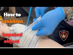 How to stabilized an impaled object: First Aid