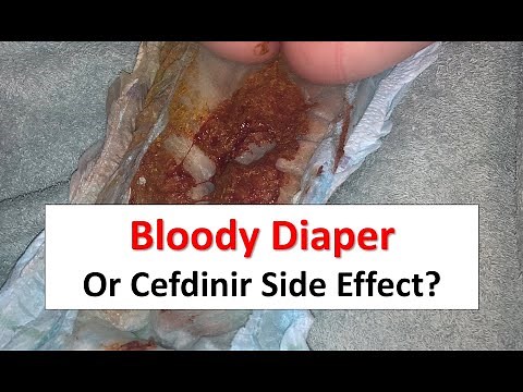 Bloody Diaper or Cefdinir Side Effect?