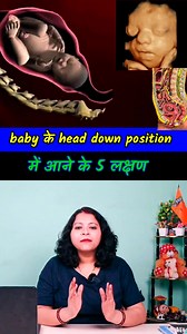 1.1M views · 15K reactions | Signs of baby head down position #fbreels #baby #pregnancy #pregnant #प्रेग्नेंसी #tips #reels #fb #Cephalicposition #pregnancyjourney #normaldelivery #fetal #fetous #laboranddelivery | Mama and Baby | Facebook