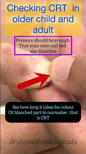 How to check Capillary Refill Time in older child and adult?#CRT#mbbs