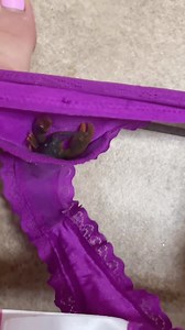 Bugging out | Leon & Lainey