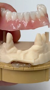 For conversion denture! | CEO Luke Kahng