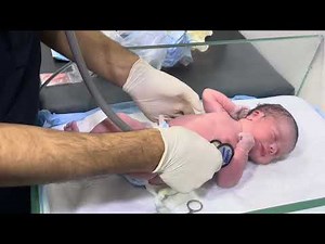 First Examination of a Newborn Baby 👶✨ | Initial Checks & Care #NewbornCare #BabyExamination