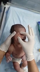 92K views · 2.1K reactions | NEWBORN BABY ORAL MEDICATION, EYE &...