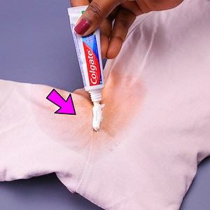 662K views · 5.2K reactions | Brilliant cloth stain removal tips & tricks!! | Artkala4u | Facebook