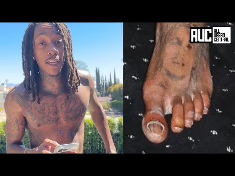 "B*tch I Got Money" Wiz Khalifa Responds After Fans ROAST How His Feet Look