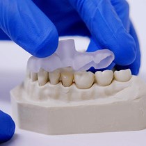 Guided Endodontics: Three-Dimensional Planning and Template-Aided Preparation of Endodontic Access Cavities