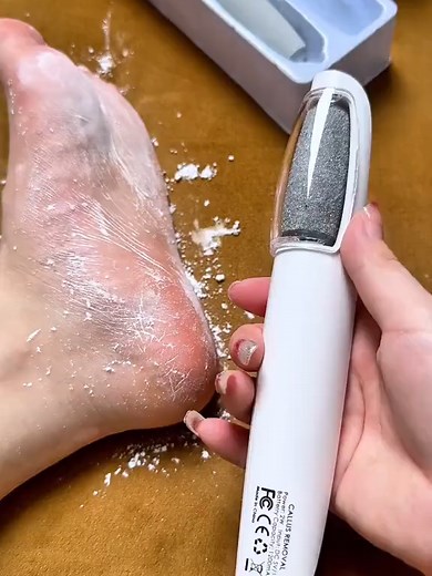 EXOVAN Electric Feet Callus Remover for Smooth Skin