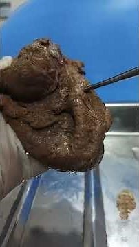 Real Viscera of urinary bladder