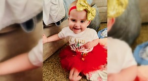 Girl with ‘mermaid syndrome’ to undergo surgery to separate legs