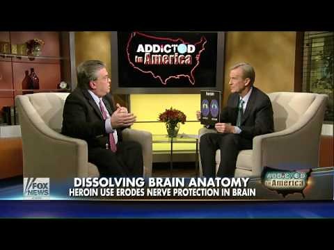 Inside the horrifying effects heroin has on the brain