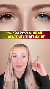 1.5K views · 13 reactions | THE RAREST HUMAN MUTATIONS! #Reels | Inet Technology Central | Facebook