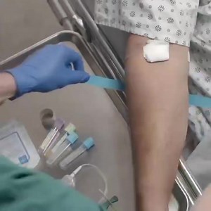 22 reactions | Here’s a quick demonstration of drawing blood with a...