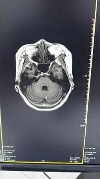 Brain MRI routine sequence