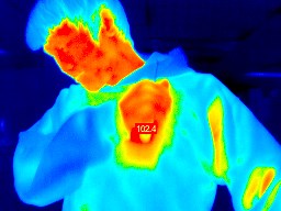 Fever detection screening thermal cameras