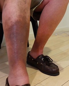 1.5K reactions · 67 comments | Healthy Legs Feel Better! State-of-the-art vein treatments from nationally accredited doctors. ✅ Covered by insurance ✅ Minimally-Invasive ✅ Board-Certified Vein Doctors ✅ 10,000+ 5-Star Reviews with 98% Patient Satisfaction | Metro Vein Centers | Facebook