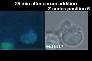 File:Generation-of-Micronuclei-during-Interphase-by-Coupling-between-Cytoplasmic-Membrane-Blebbing-and-pone.0027233.s008.ogv - Wikimedia Commons
