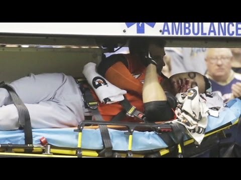 MLB's Stanton hit by pitch in the face