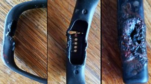 'My arm, it was like plastic and blood:' woman describes exploding fitness tracker