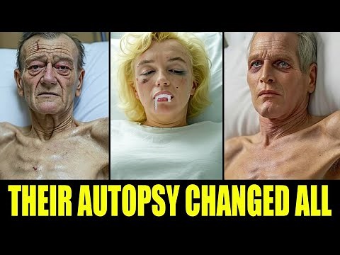 15 Autopsy Results That Shocked Hollywood