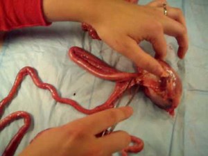 Poultry Digestive Tract