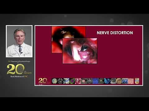 Microvascular Decompression for Trigeminal Neuralgia and Hemifacial Spasms