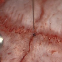 Video: Microelectrode Guided Implantation of Electrodes into the Subthalamic Nucleus of Rats for Long-term Deep Brain Stimulation