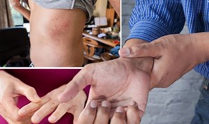 Arthritis: Doctor gives advice on best foods to help ease pain