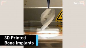 336K views · 3.5K reactions | 3D-printed bones? This material could let doctors print implants on demand. | Futurism | Facebook