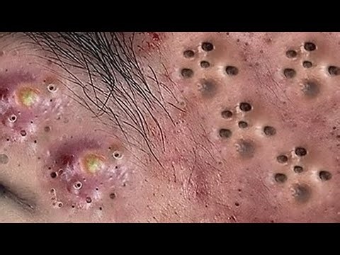 𝑹𝒆𝒎𝒐𝒗𝒊𝒏𝒈 𝑫𝒊𝒓𝒕 𝑼𝒏𝒅𝒆𝒓 𝑻𝒉𝒆 𝑺𝒌𝒊𝒏 𝑰𝒔 𝑹𝒆𝒇𝒓𝒆𝒔𝒉𝒊𝒏𝒈 𝑨𝒏𝒅 𝑹𝒆𝒍𝒂𝒙𝒊𝒏𝒈 #6666888