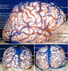 Parietal and Occipital AVMs | Cohen Collection | Volumes | The Neurosurgical Atlas