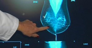 FDA adding breast cancer screening regulations